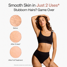Laser Hair Removal Handset – IPL At‑Home Permanent Hair Reduction Device