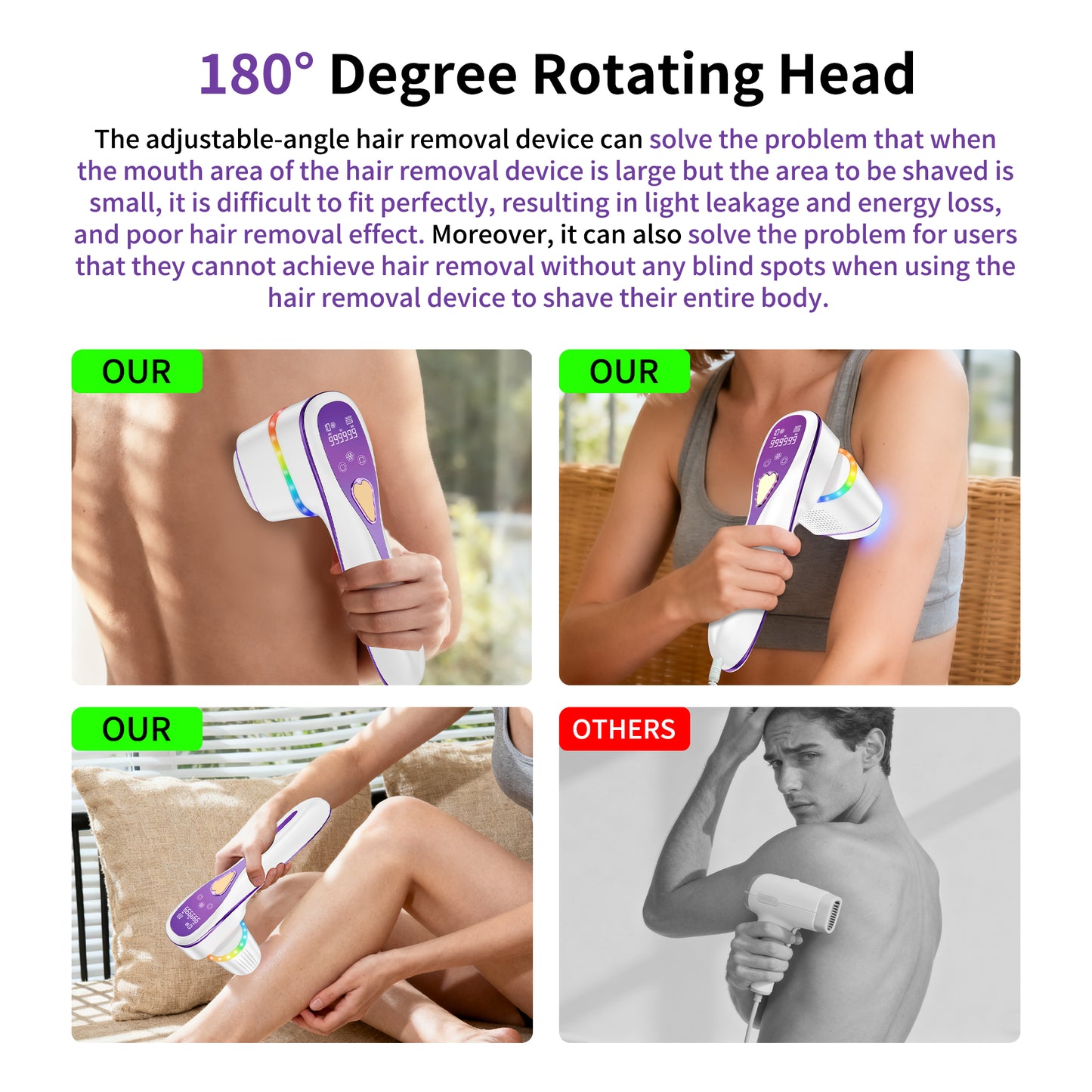 Laser Hair Removal Handset – IPL At‑Home Permanent Hair Reduction Device