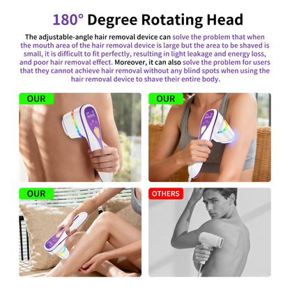 Laser Hair Removal Handset – IPL At‑Home Permanent Hair Reduction Device